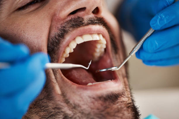 Best Broken Tooth Emergency  in Hildale, UT