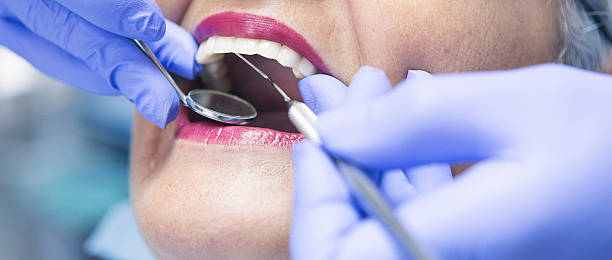 Best Chipped Tooth Repair Near Me  in Hildale, UT
